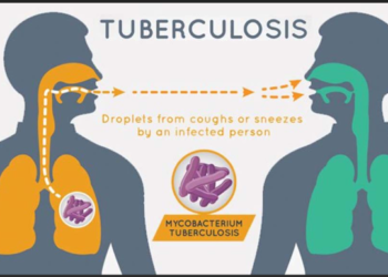 Warga Bakungan Diajak Kenali Gejala TBC Lewat Penyuluhan Kesehatan